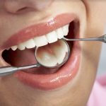 Implanty zębów – Czy mogą nam zastąpić prawdziwe zęby?