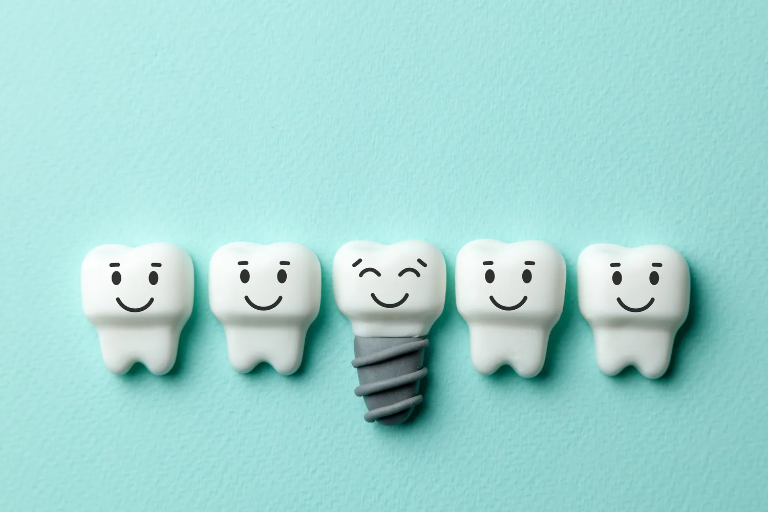 Gdzie najtaniej zrobić implanty?