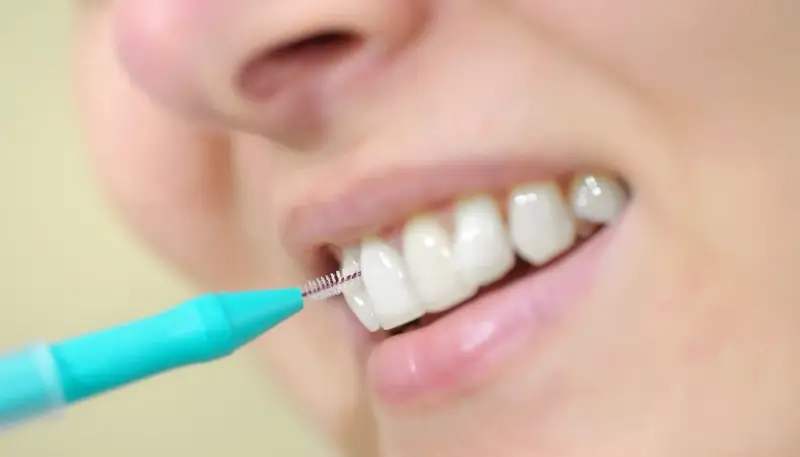 Implanty dentystyczne