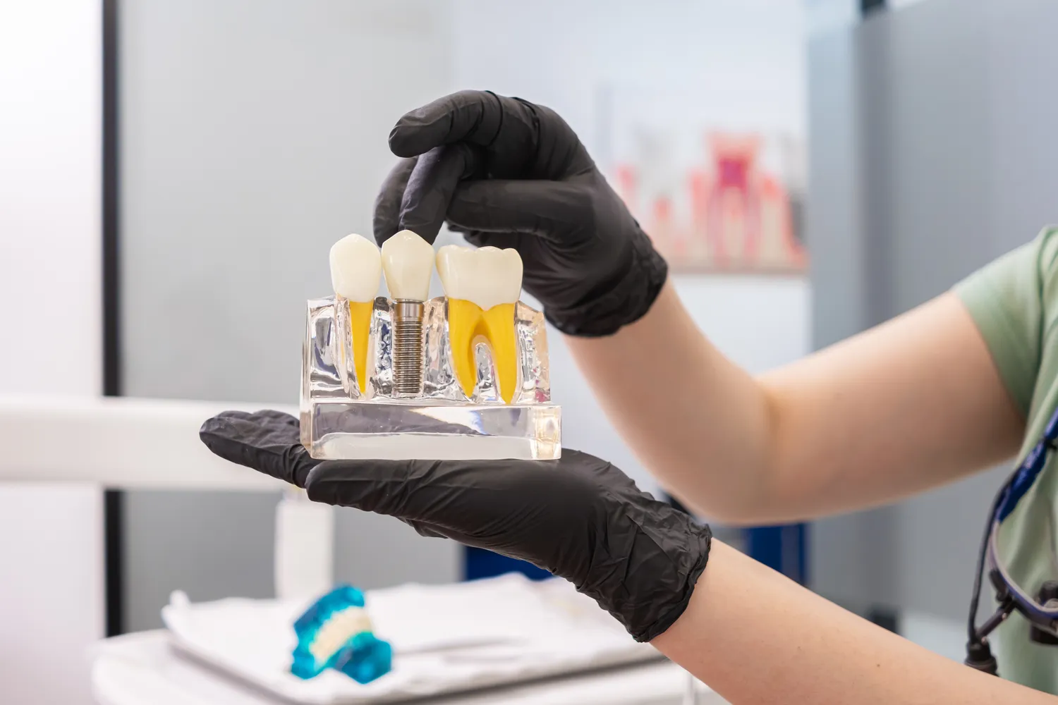 Implanty ile kosztują?