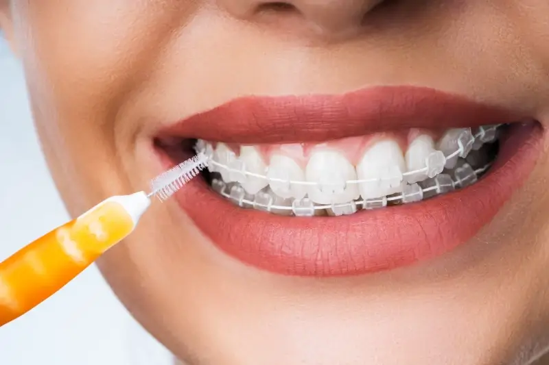 Marketing stomatologiczny